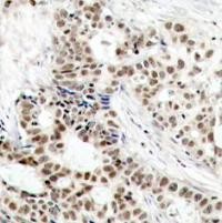 BRCA1 (phospho Ser1423) Antibody