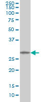 MMP26 Antibody (monoclonal) (M01)