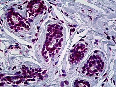RUNX1 Antibody