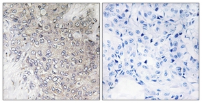 p70 S6 Kinase (Phospho-Thr421) antibody