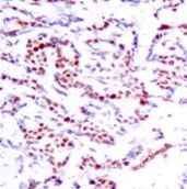 ATF2 (phospho Ser112 / 94) Antibody