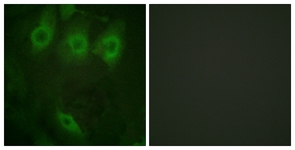 EGFR (Phospho-Tyr1016) antibody