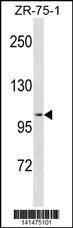 PGR Antibody