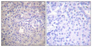 IRS-1 (Phospho-Ser612) antibody