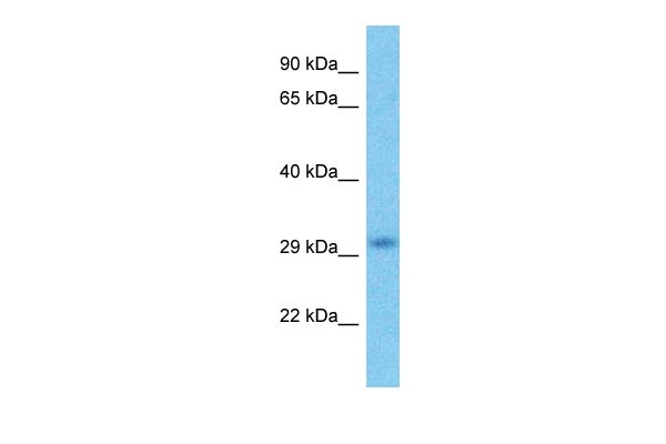 HDAC1 Antibody - C-terminal region