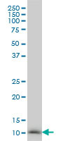 NDUFB3 Antibody (monoclonal) (M01)