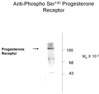 Progesterone Receptor (phospho Ser190) Antibody