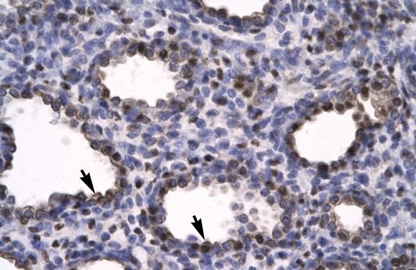 HMGB2 antibody - C-terminal region