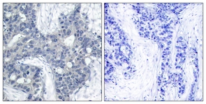 PYK2 (Phospho-Tyr402) antibody