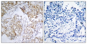 IGF1R (Phospho-Tyr1161) antibody