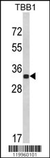 His Tag Antibody