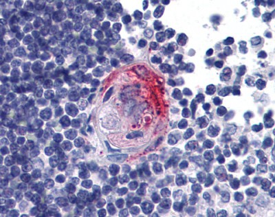 AKT2 Antibody
