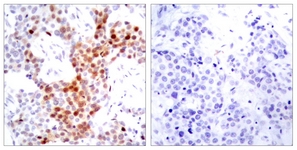 ATF2 (Phospho-Thr69 or 51) antibody