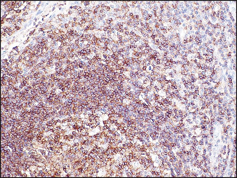 PTPRC Antibody
