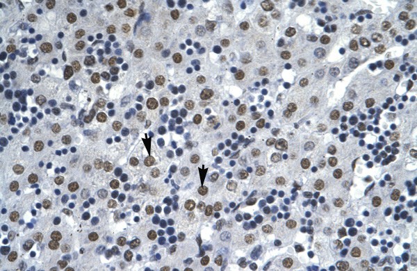 AATF antibody - N-terminal region