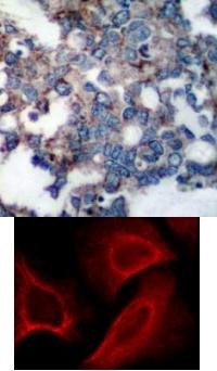 p70 S6 Kinase (phospho Ser424) Antibody