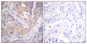 Lck (Phospho-Tyr505) antibody
