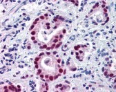 Histone Deacetylase 1 Antibody