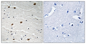 AKT1/2/3 antibody