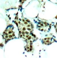P38 MAPK (phospho Tyr182) Antibody
