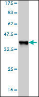 NFE2L2 Antibody (monoclonal) (M03)