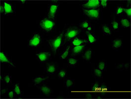 MKNK2 Antibody (monoclonal) (M04)