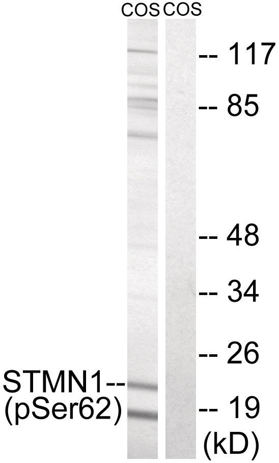 STMN1 (phospho Ser62) Antibody