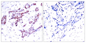 STAT1 (Phospho-Tyr701) antibody