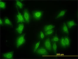 MKNK1 Antibody (monoclonal) (M08)