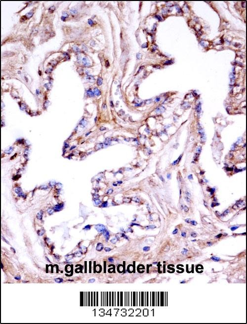 Mouse Akt1 Antibody