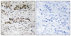 Estrogen Receptor-alpha (Phospho-Ser102) antibody