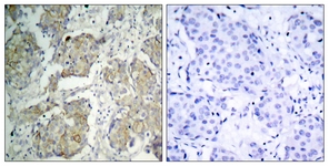 VEGFR2 (Phospho-Tyr1214) antibody