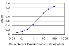 MKI67 Antibody (monoclonal) (M01)