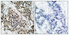 FKHR (Phospho-Ser256) antibody