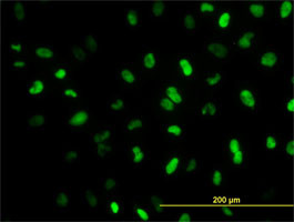 MEIS2 Antibody (monoclonal) (M01)