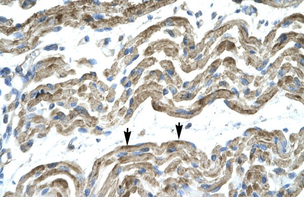 C13ORF8 antibody - middle region