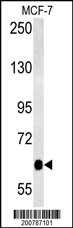 NTKL Antibody (Ascites)