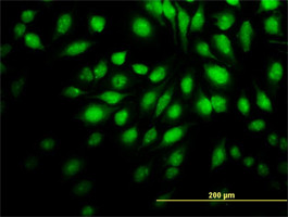 NR4A2 Antibody (monoclonal) (M02)