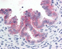 c-Met Antibody, Monoclonal
