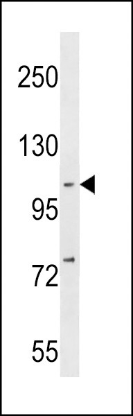 NFKB Antibody