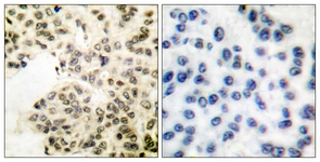 NF-kappaB p65 (Phospho-Ser311) antibody