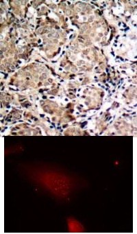 FKHR (phospho Ser319) Antibody