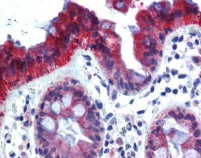 Cytoke Antibody