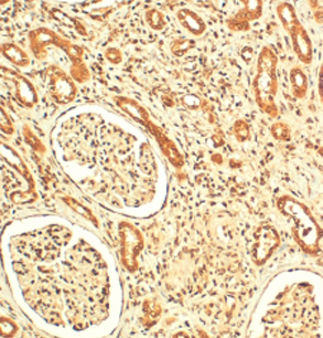 14 3 3 zeta Antibody