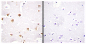 c-Jun antibody