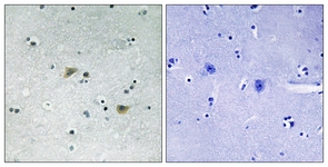 Src (Phospho-Ser75) antibody