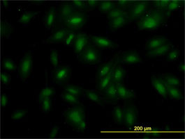 MAK Antibody (monoclonal) (M02)