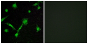 IkappaB-alpha (Phospho-Ser32/Ser36) antibody