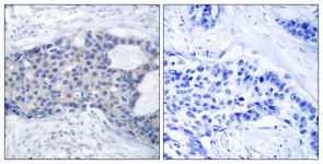 ZAP-70 (Phospho-Tyr493) antibody