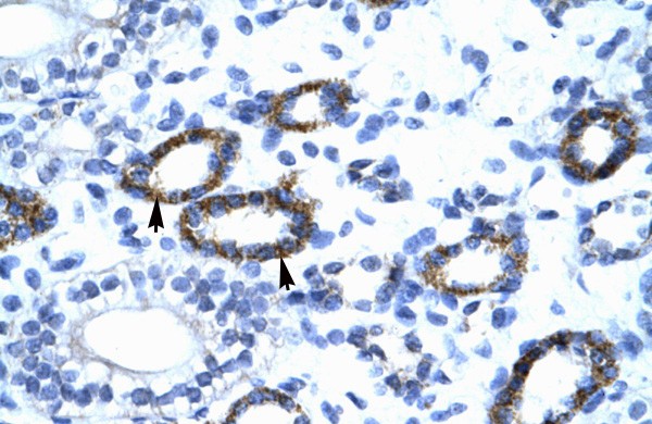 GTF2F2 antibody - C-terminal region